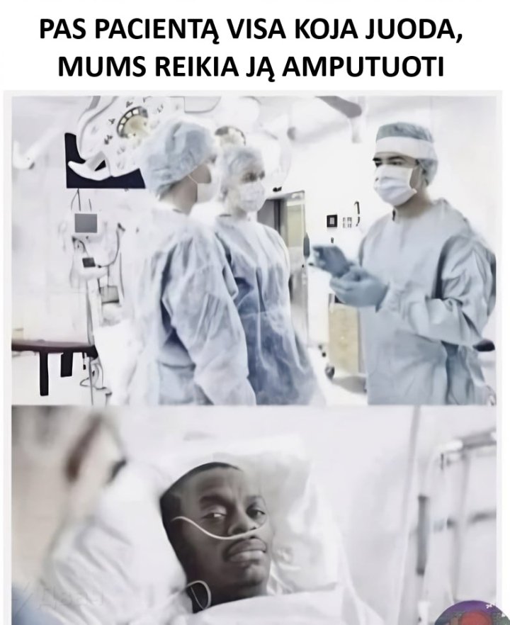 amputacija